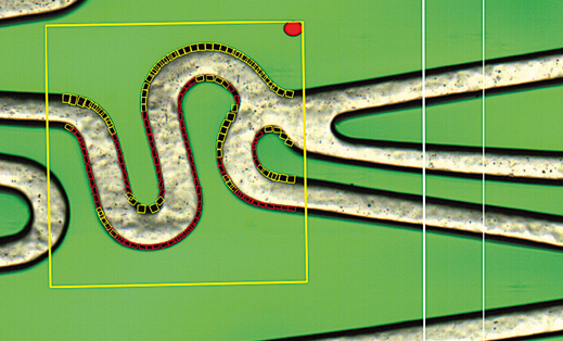 Strut Edges measurement for stents