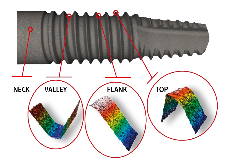 cs_dental-implant-surface1 cs_dental-implant-surface1