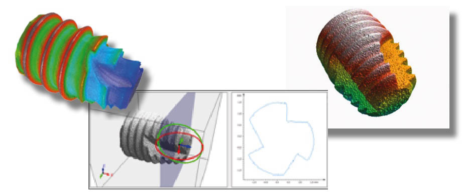 cs_dental-implant-surface5 cs_dental-implant-surface5