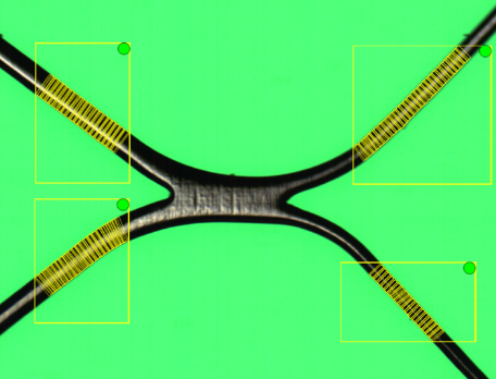 Dimensional Analysis Neurovascular stents Dimensional Analysis Neurovascular stents