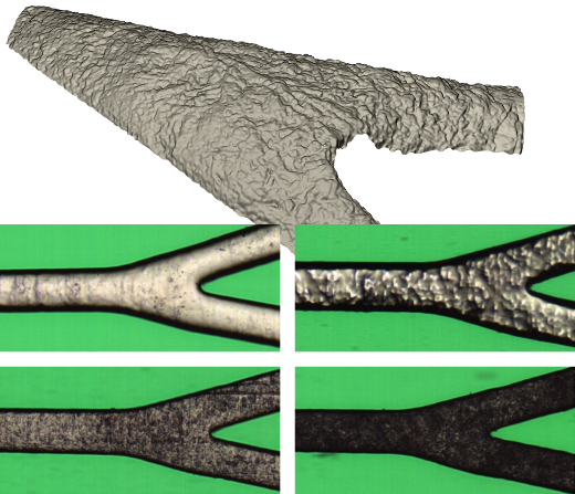 Stent and textures