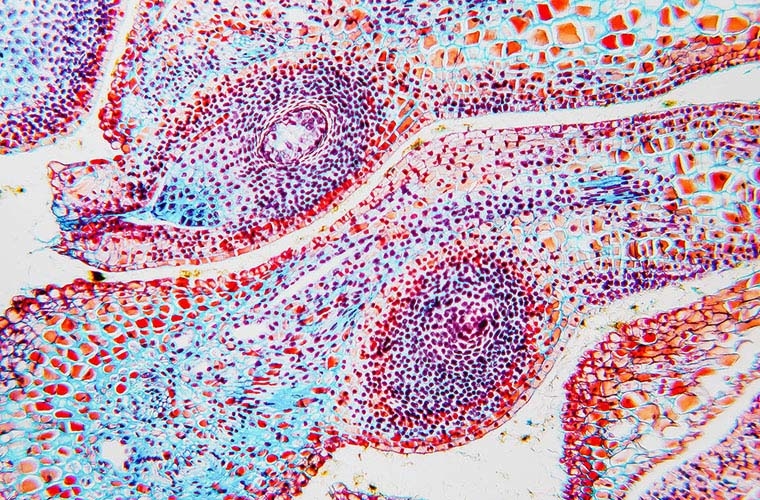生物学的応用向けナノプレッシャーセンサーの初期たわみ測定 生物学的応用向けナノプレッシャーセンサーの初期たわみ測定