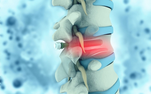 Qualitätskontrolle bei der Herstellung medizinischer Implantate