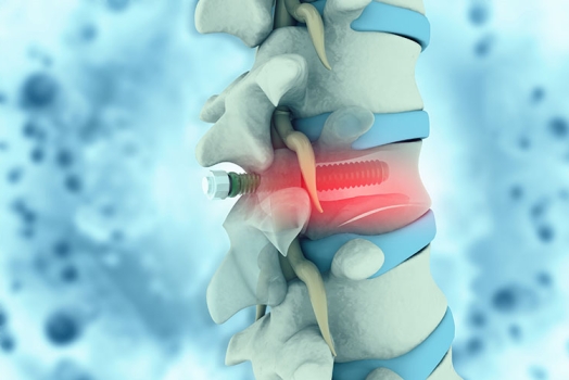 Qualitätskontrolle bei der Herstellung medizinischer Implantate