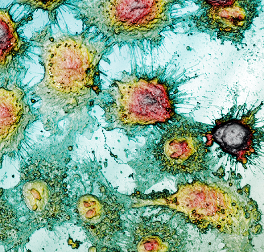 Morphologische Oberflächenanalyse zur Untersuchung der Zelllebensfähigkeit