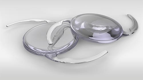Intraocular lens implant Intraocular lens implant
